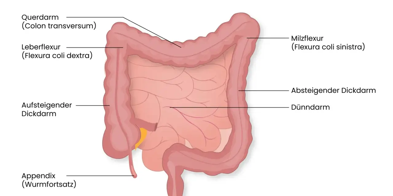 Der Aufbau des Darms: Dickdarm mit Querdarm, Leberflexur, aufsteigendem und absteigendem Dickdarm, Appendix, Rektum und dem zentralen Dünndarm.