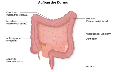 Der Aufbau des Darms: Dickdarm mit Querdarm, Leberflexur, aufsteigendem und absteigendem Dickdarm, Appendix, Rektum und dem zentralen Dünndarm.