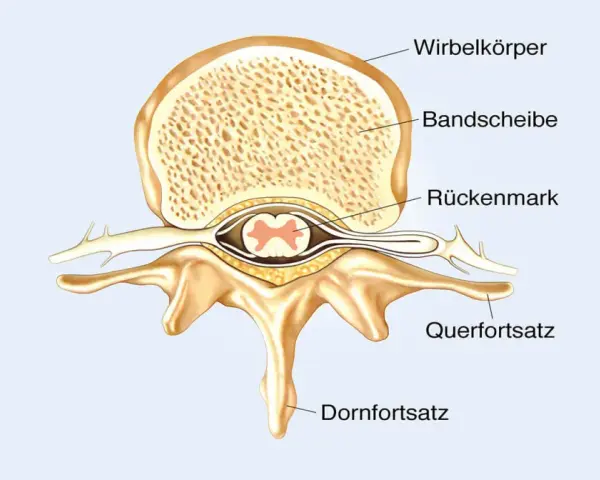 Querschnitt eines Wirbels mit Bandscheibe und dem zentralen Rückenmark.