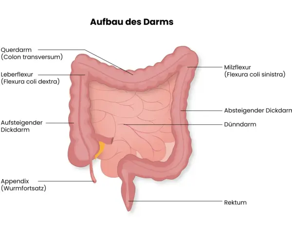 Der Aufbau des Darms: Dickdarm mit Querdarm, Leberflexur, aufsteigendem und absteigendem Dickdarm, Appendix, Rektum und dem zentralen Dünndarm.
